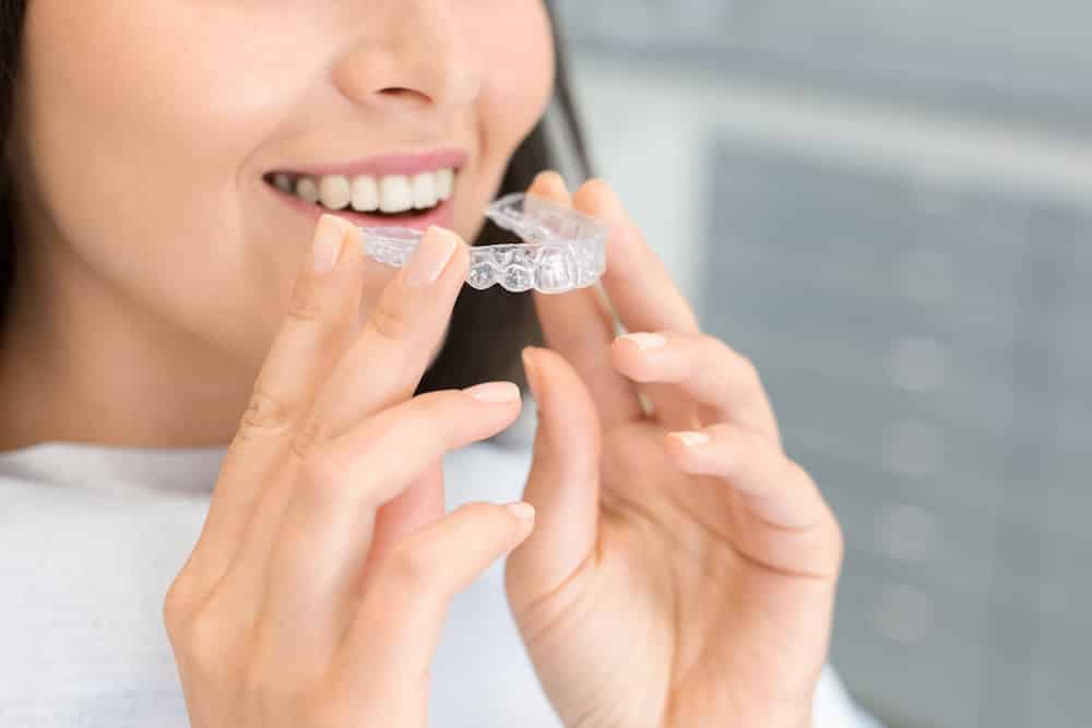 best age to get invisalign